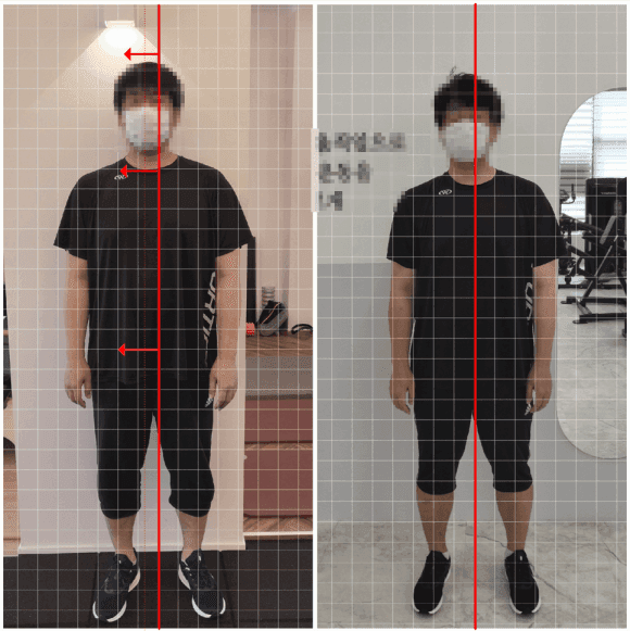 회원 운동 전후 비교 사진 13 — 정면 전신 정렬