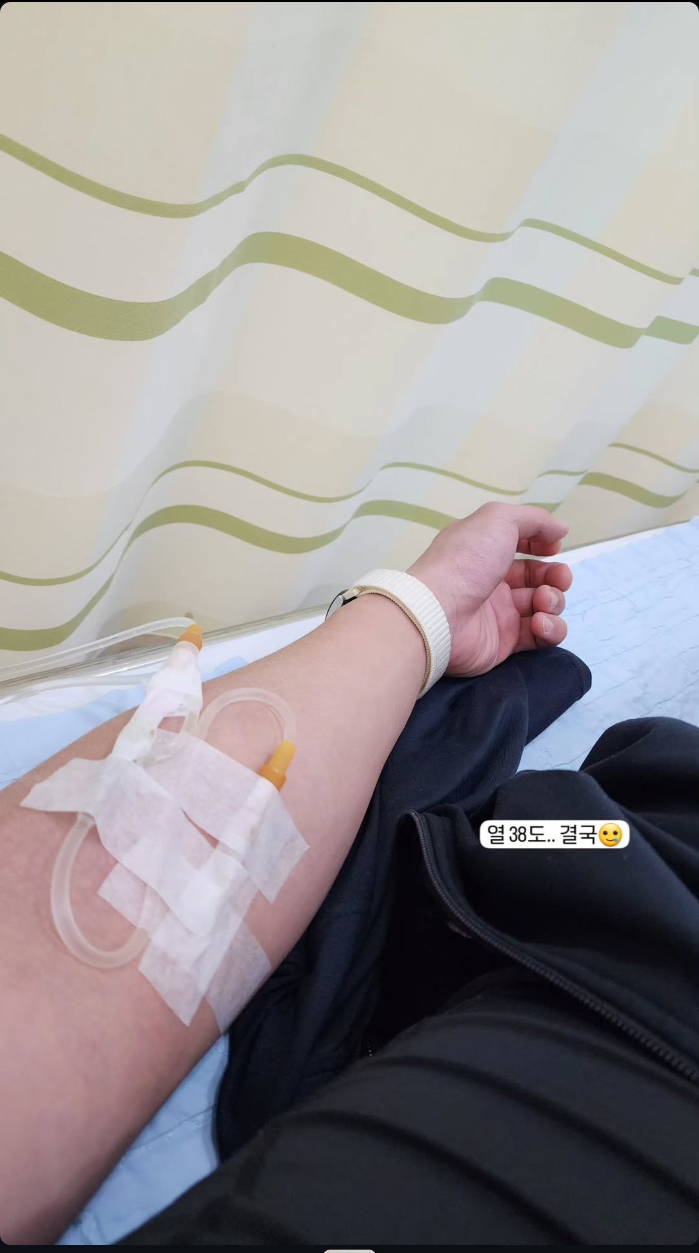 양쪽 발목 골절 & 인대 완전파열